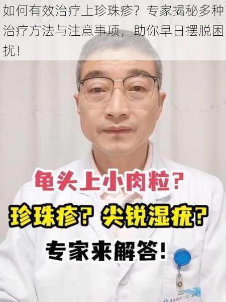 如何有效治疗上珍珠疹？专家揭秘多种治疗方法与注意事项，助你早日摆脱困扰！