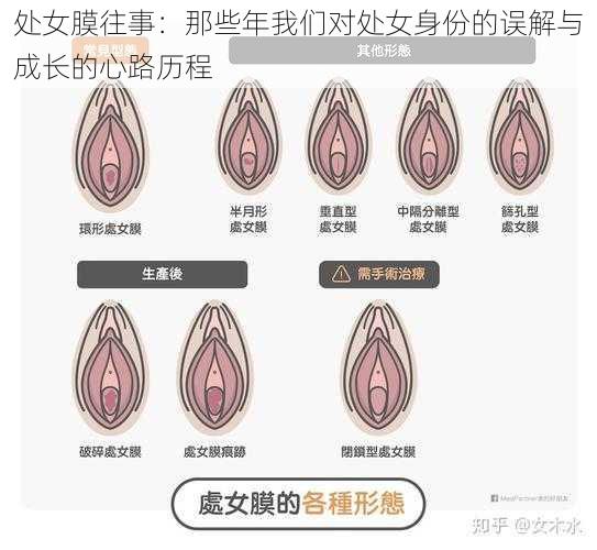 处女膜往事：那些年我们对处女身份的误解与成长的心路历程