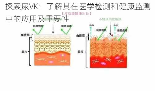 探索尿VK：了解其在医学检测和健康监测中的应用及重要性