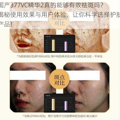 国产377VC精华2真的能够有效祛斑吗？揭秘使用效果与用户体验，让你科学选择护肤产品！