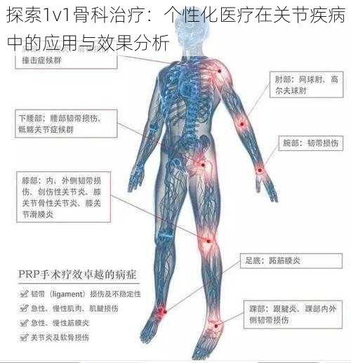 探索1v1骨科治疗：个性化医疗在关节疾病中的应用与效果分析